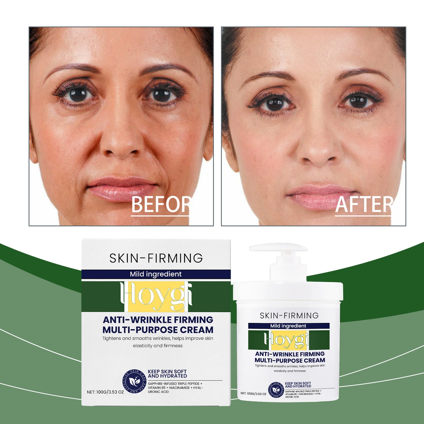 Hoygi Moisturizing Cream Nourishes The Face, Hydrates The Skin, Moisturizes The Skin, And Moisturizes The Skin